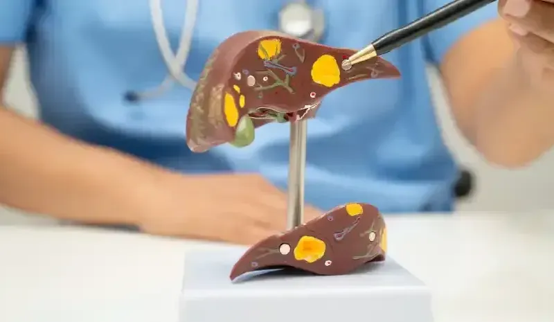 Fatty Liver Diet - Foods to Eat and Avoid