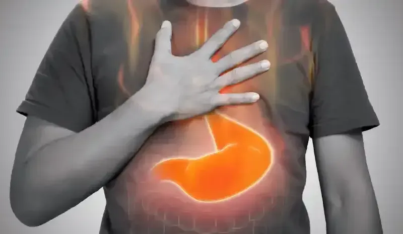 Acid Reflux - Causes & Medical Treatment Options