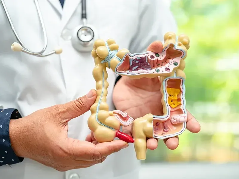 Home Remedies for Indigestion - 10 Natural Ways to Support Digestion