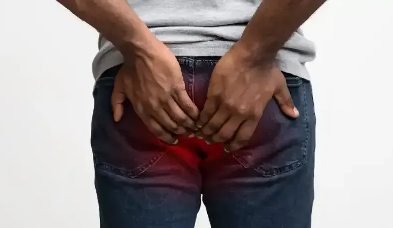 How to Heal Fissure Faster - Guide to Anal Fissure Treatment