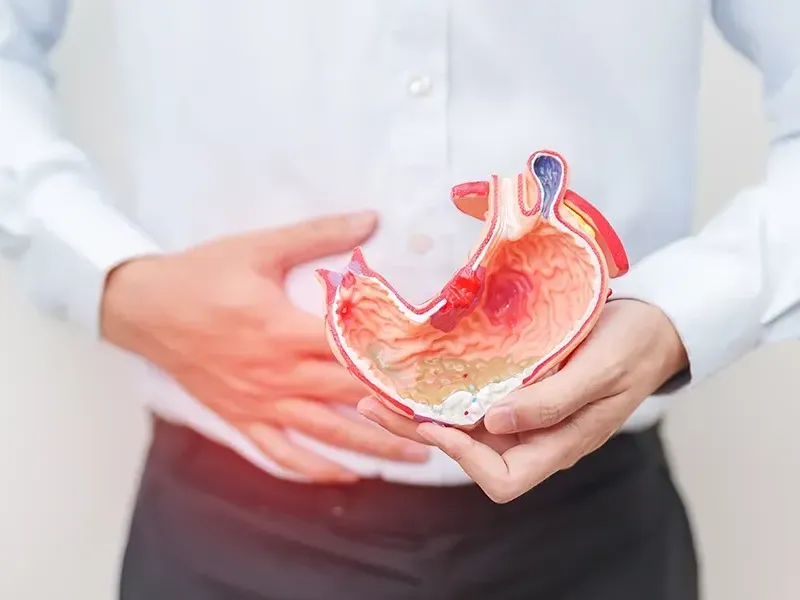 acid-reflux-complications-and-treatment