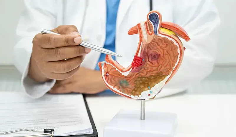 Foods To Eat with Gastritis for Better Digestive Comfort