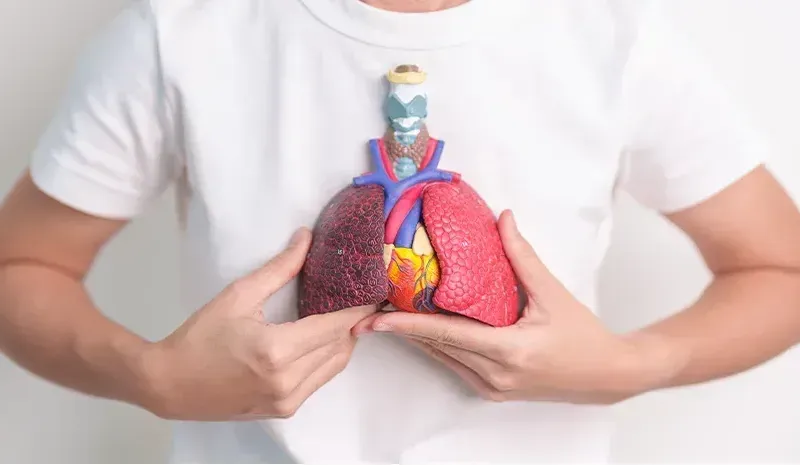 Cystic Fibrosis Management
