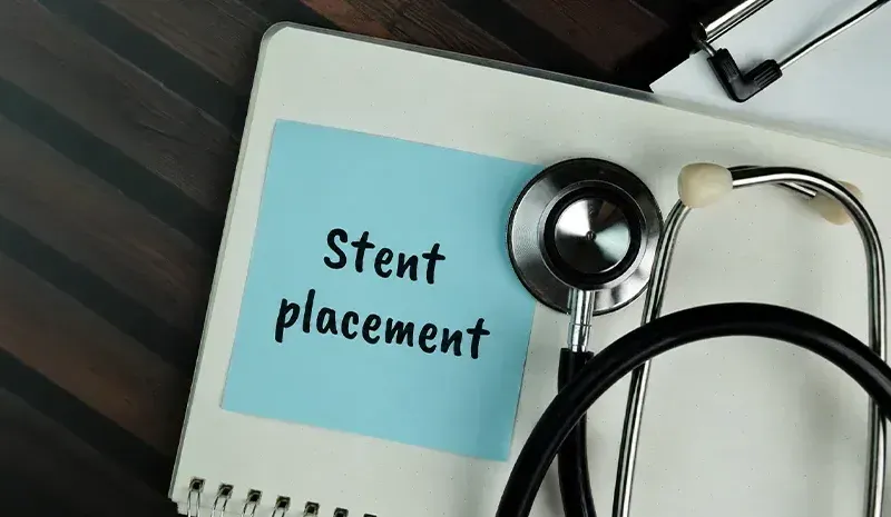 Heart Stent & Kidney Stent Placement