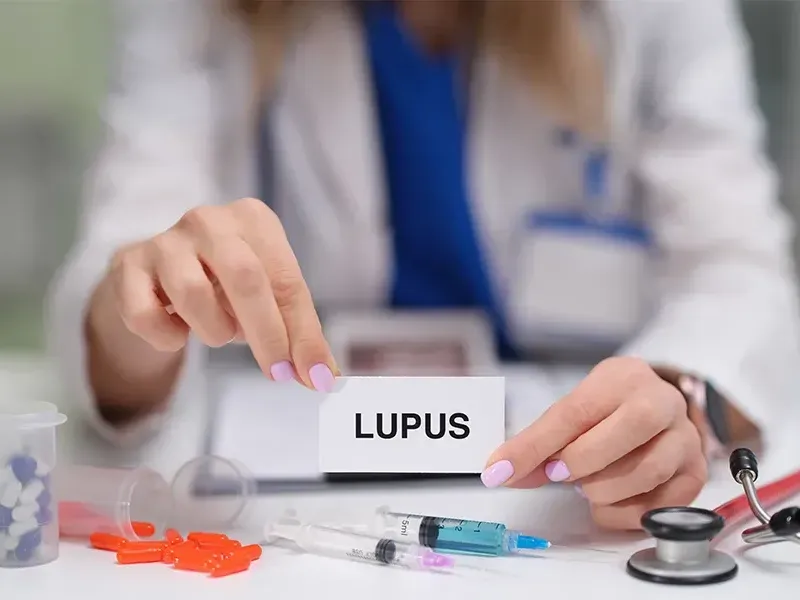 Lupus - A Guide to Organ Involvement and Symptoms