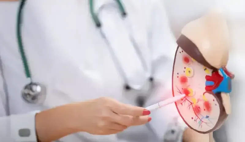 kidney-stone-treatment-and-recovery-guide