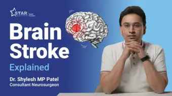 Brain Stem Stroke