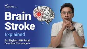 Brain Stroke Explained: Causes, Early Signs & Emergency Treatment Guide