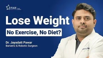 Star Health - Can You Lose Weight Without Exercise Or Diet? | How to Lose Weight | Bariatric Surgery