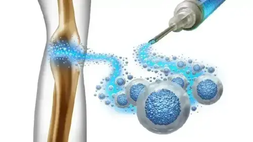 Is Stem Cell Therapy covered in Health Insurance?