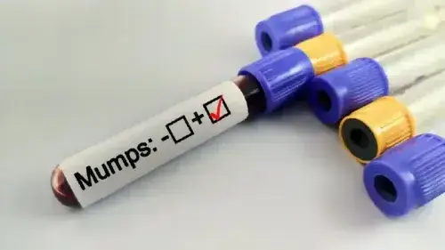 Mobile Banner
