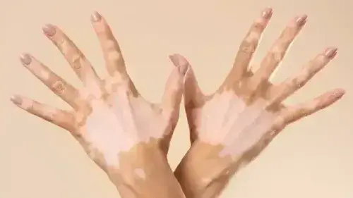 Mobile Banner