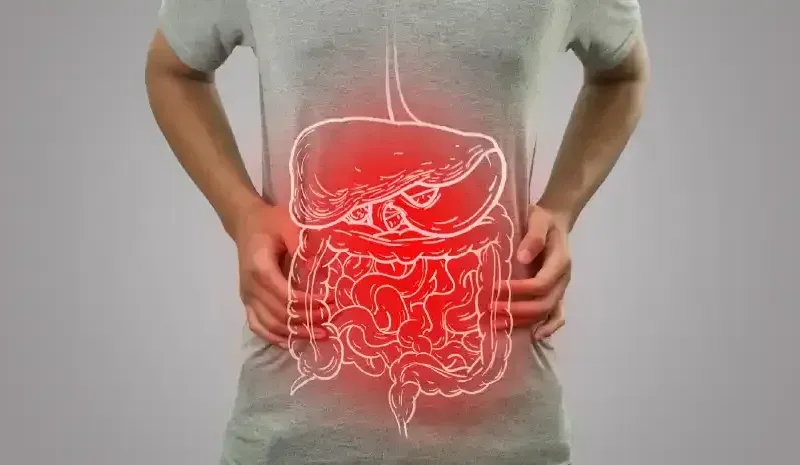 A Complete Guide to Crohn's Disease Treatment