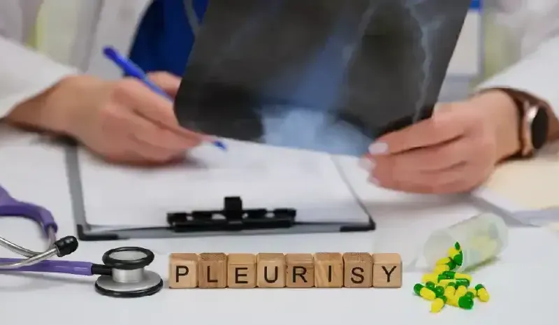 Pleurisy - Diagnosis and Treatment