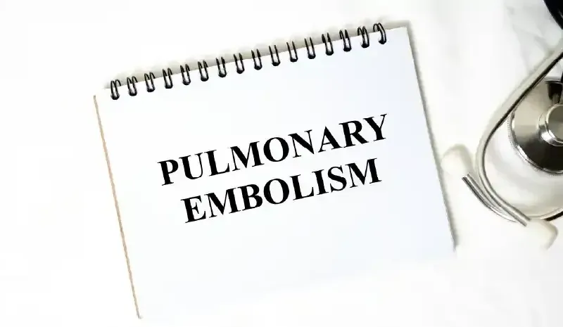 Pulmonary Embolism: Treatment Options and Medical Care