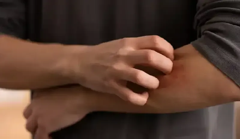 Treatments for Skin Allergies and Rashes