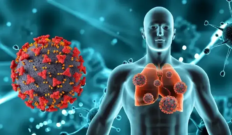 Understanding Recovery After Pneumonia