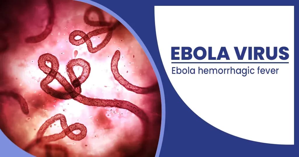 Ebola Virus  Symptoms, Causes, Treatments, and Prevention   
