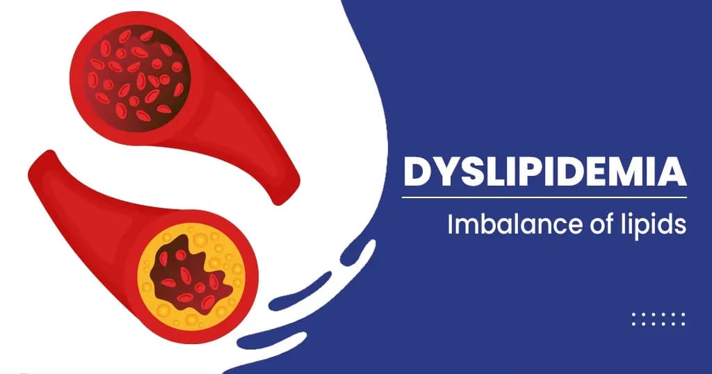 Dyslipidaemia Symptoms, Causes, Diagnosis, and Treatment  