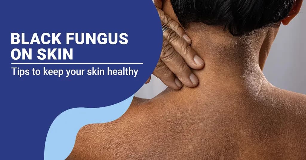 Black fungus infection on skin – Symptoms, Treatment, Causes