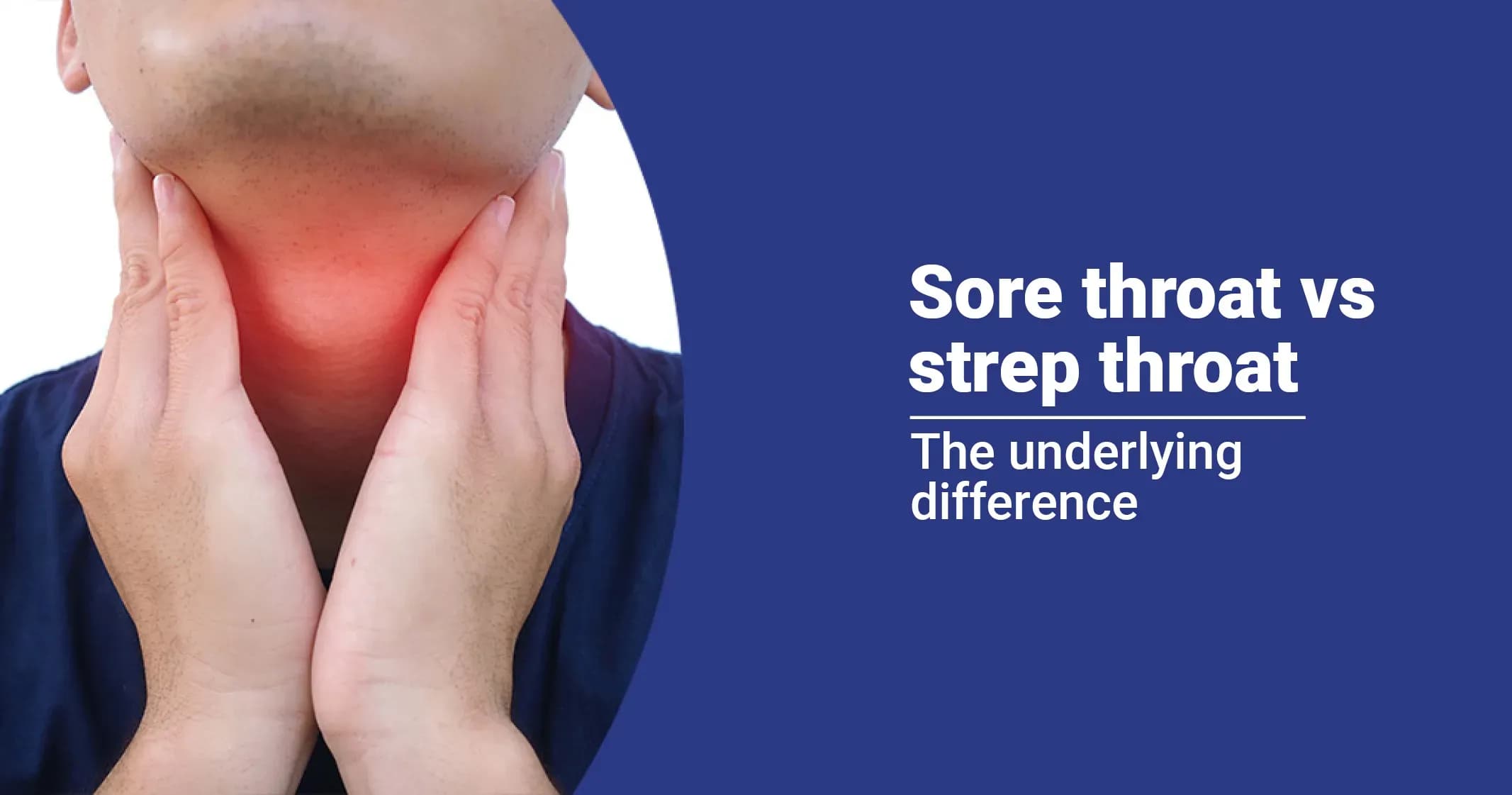 Sore Throat vs. Strep Throat: How to Tell the Difference 