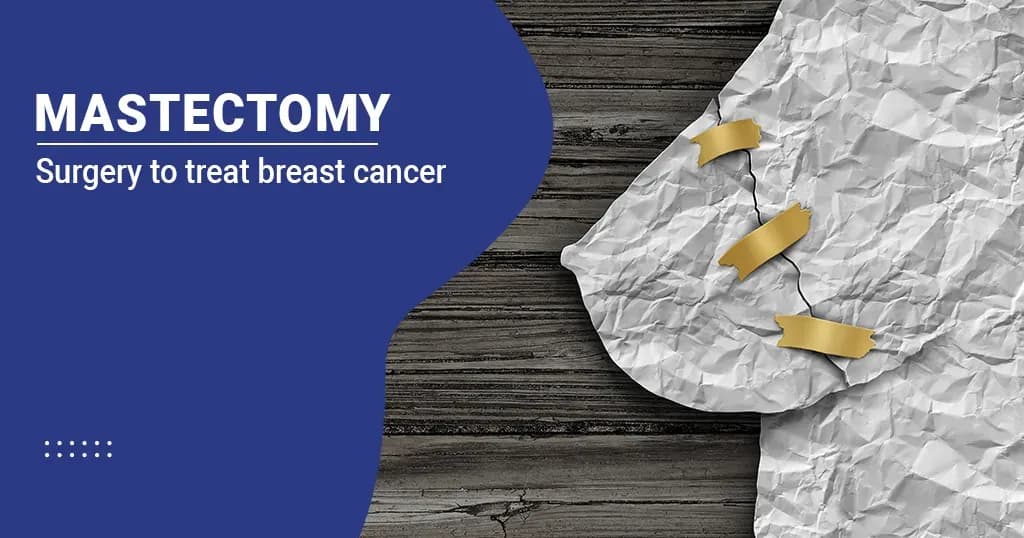 Mastectomy (Breast removal surgery) - Types and Procedure