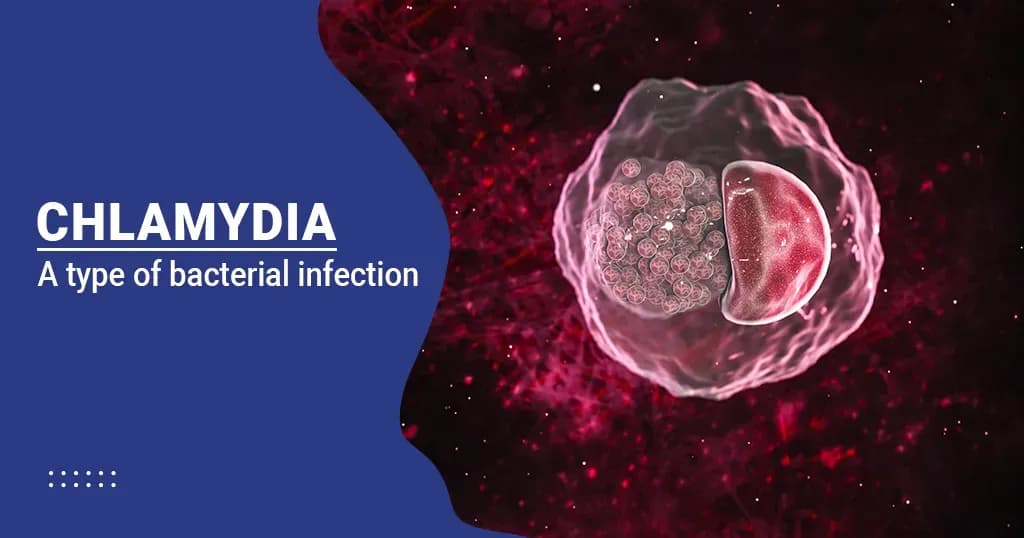 Chlamydia Treatment, Causes, Symptoms and Prevention