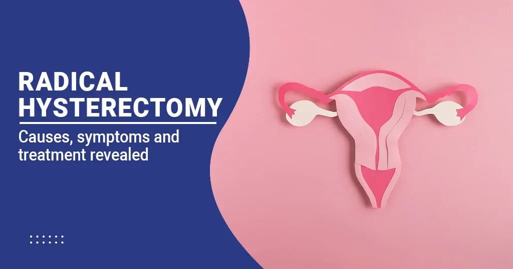 Radical Hysterectomy Causes, Symptoms and Treatment