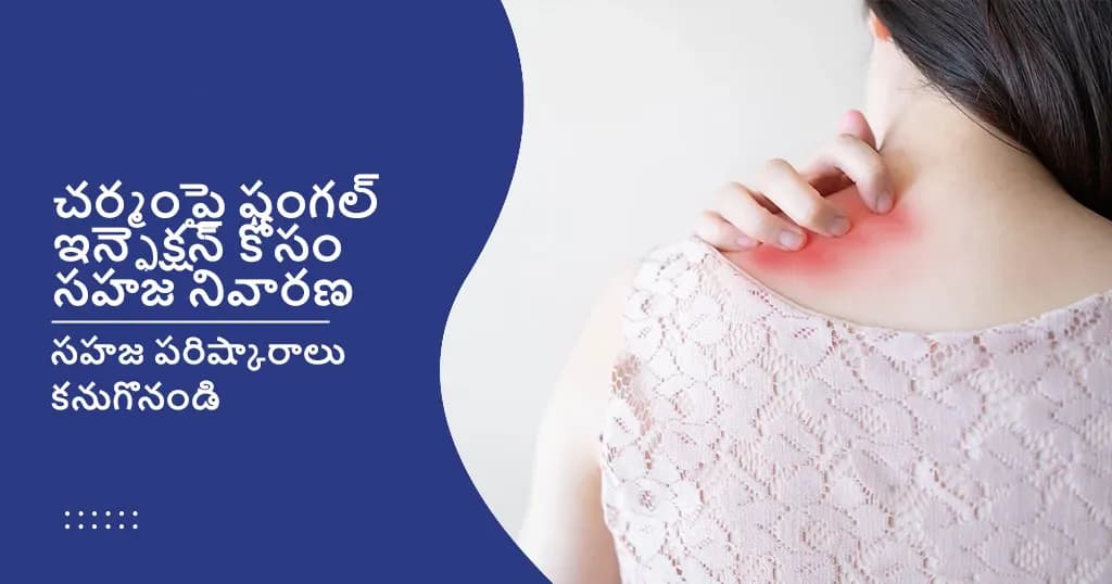 చర్మంపై ఫంగల్ ఇన్ఫెక్షన్ కోసం అద్భుతమైన 15 సహజ ఇంటి నివారణలు