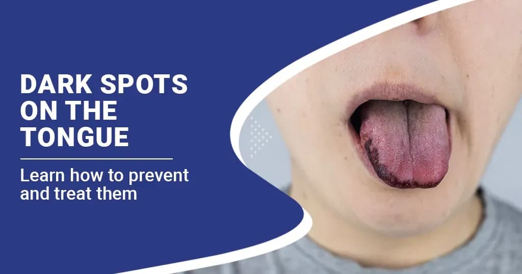 Dark Spots on the Tongue