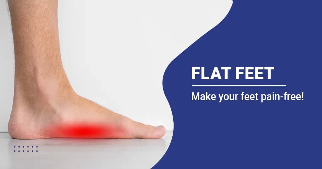 Flat Feet Causes, Symptoms and Treatment