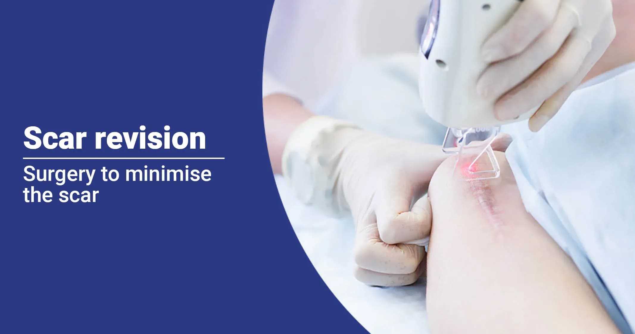 Scar Revision Benefits, Types and Treatment