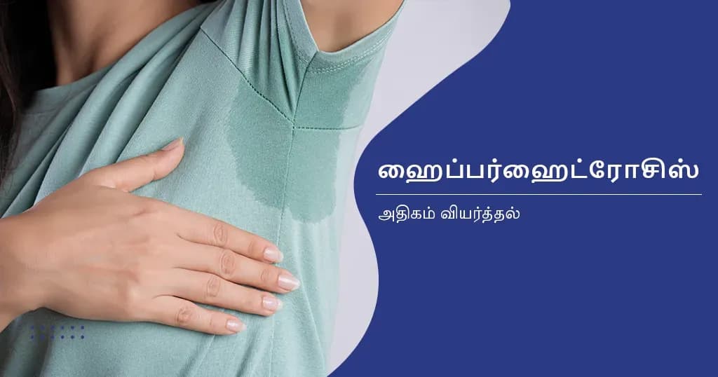 ஹைப்பர்ஹைட்ரோசிஸ் - காரணங்கள், அறிகுறிகள் மற்றும் சிகிச்சைகள்