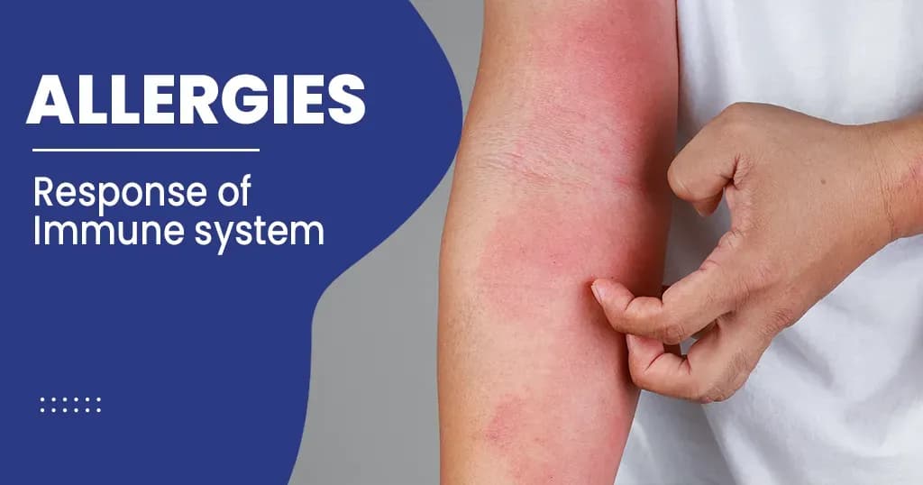 Allergy Types, Symptoms, and Treatments
