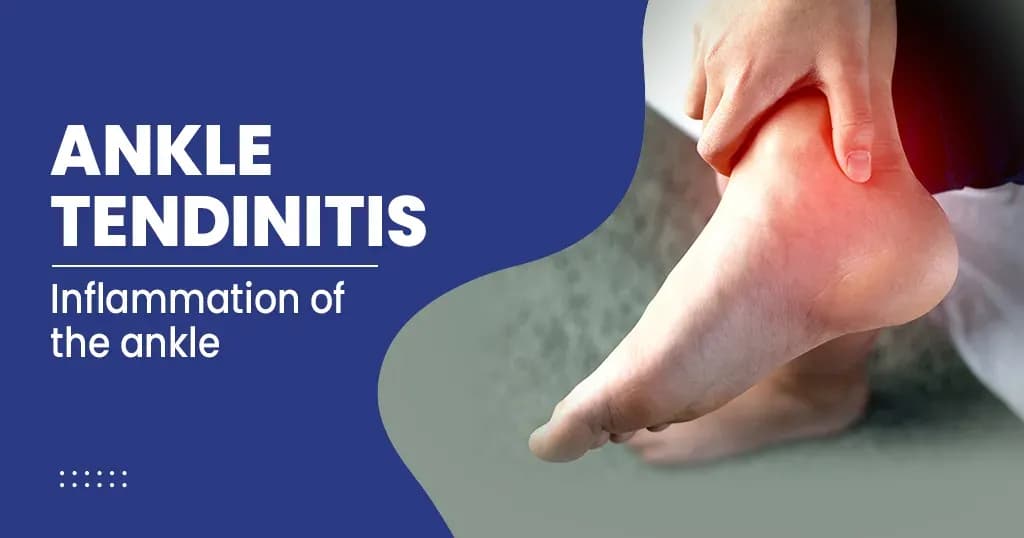 Ankle Tendonitis (Tendonitis) Risk Factors, Causes, Symptoms