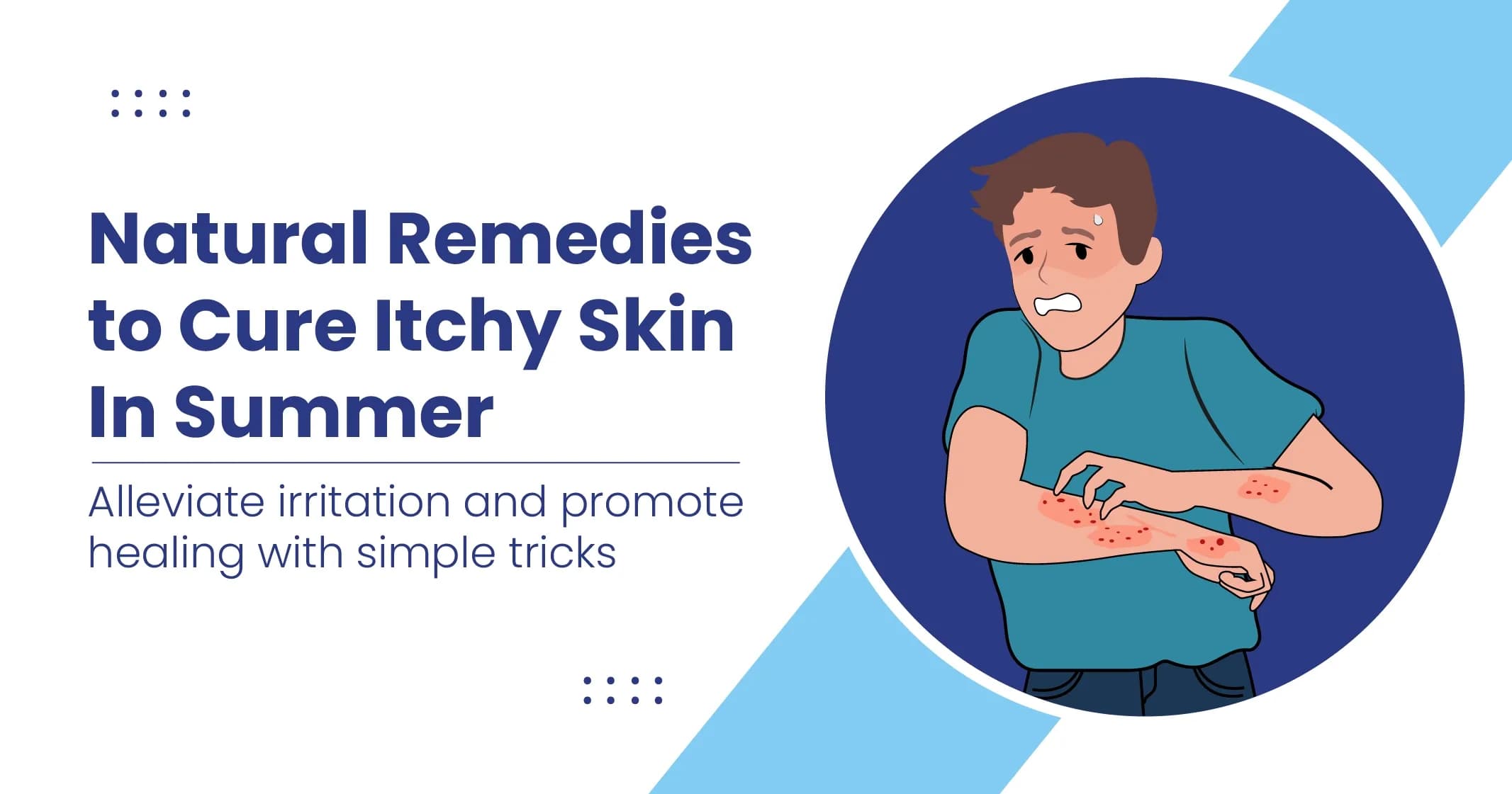 Home Remedies for Itchy Skin Cure
