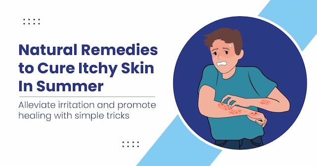 Home Remedies for Itchy Skin Cure
