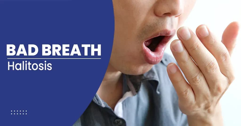 Bad Breath Causes and Treatment