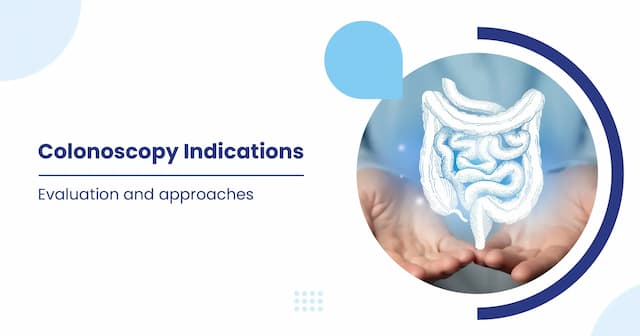 A Guide to Colonoscopy Indications, its Preparation and Procedure 