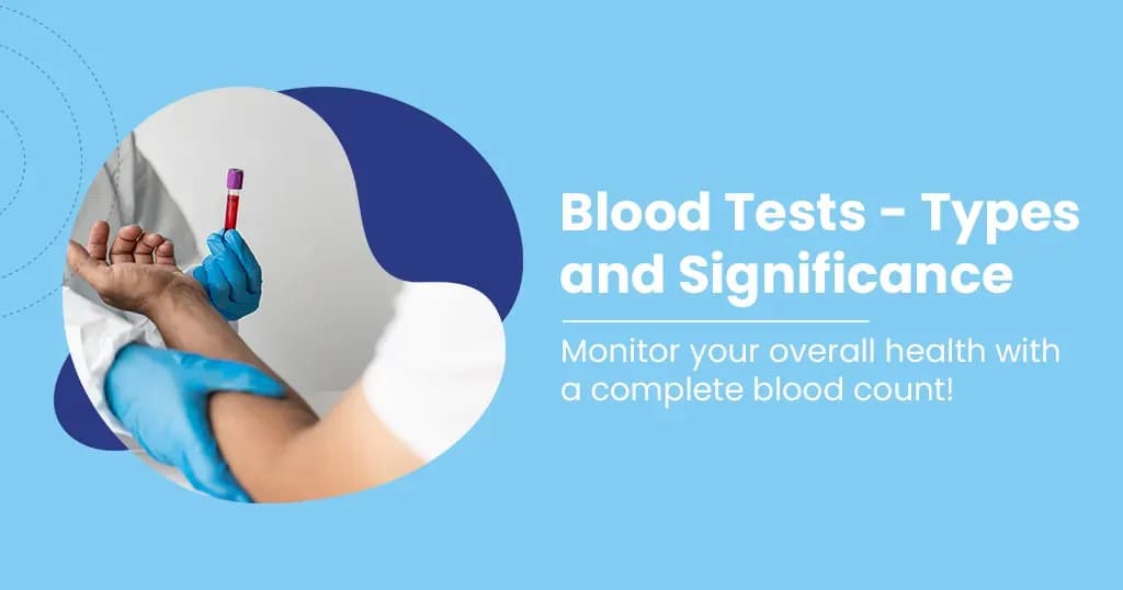 List of Common Blood Tests Types