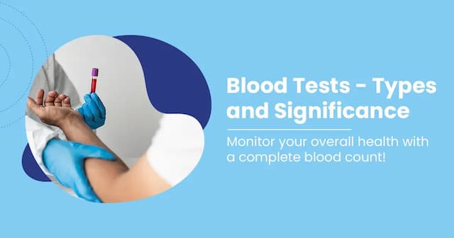 List of Common Blood Tests Types