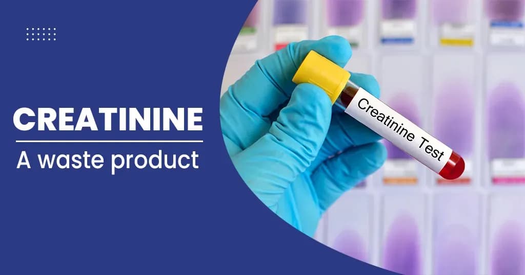 Creatinine Test Normal Levels