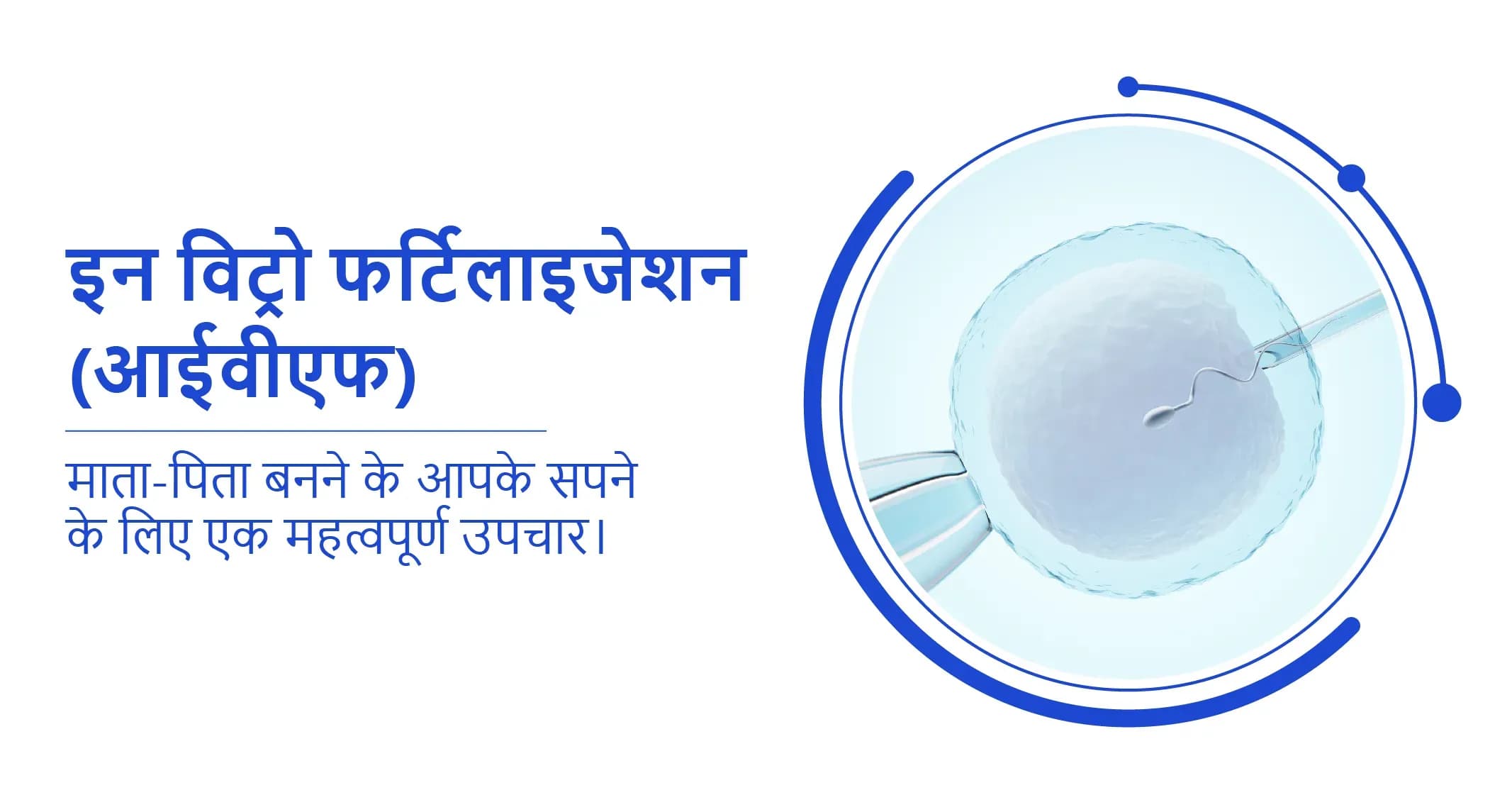 इन विट्रो फर्टिलाइजेशन (आईवीएफ) - प्रक्रिया और यह कैसे काम करता है?