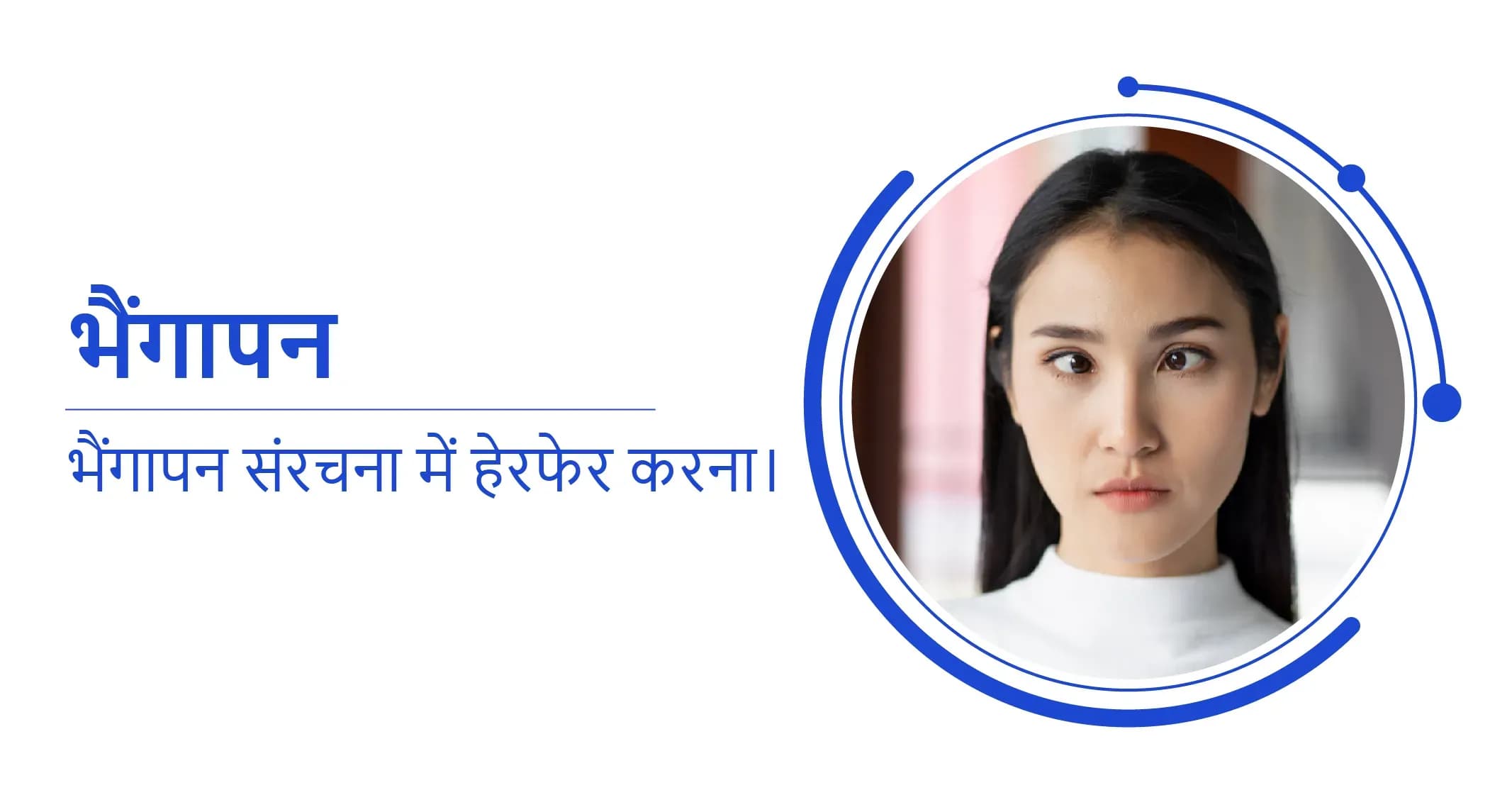 भैंगापन