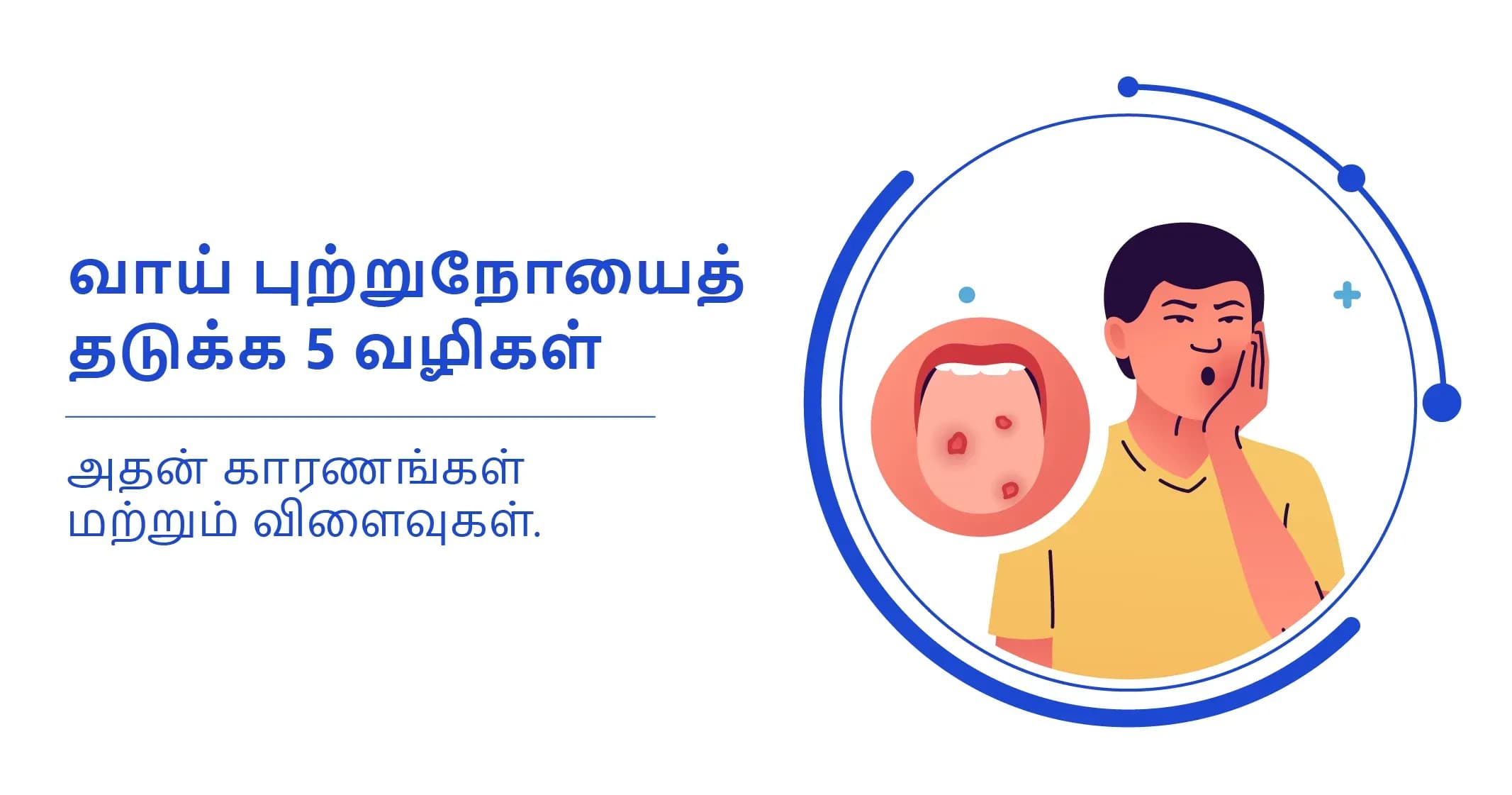 வாய்ப்புற்றுநோயைத் தடுக்க உதவும் 5 எளிய வழிகள்