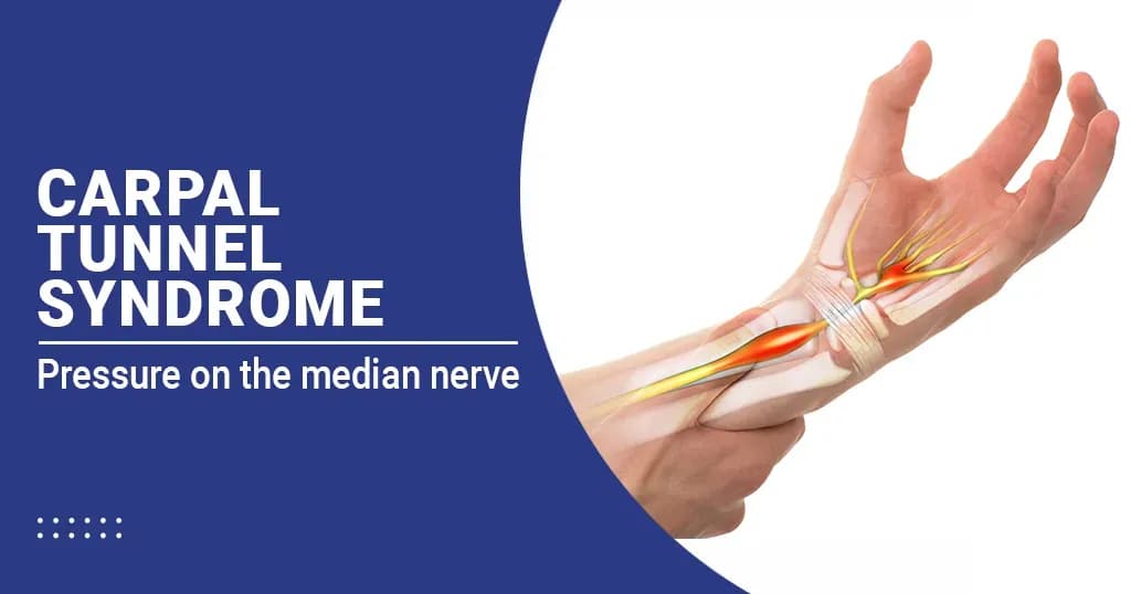 3 Exercises for Treating Carpal Tunnel Syndrome 