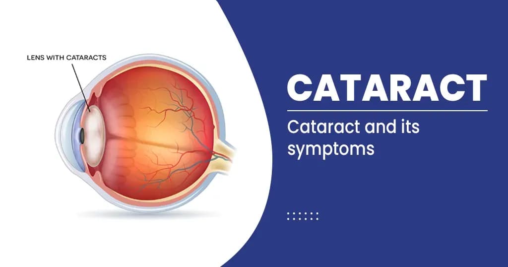 Cataract Symptoms, Causes and Risk factors