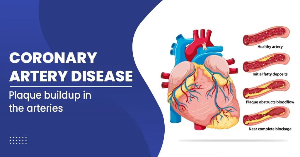Coronary Artery Disease 