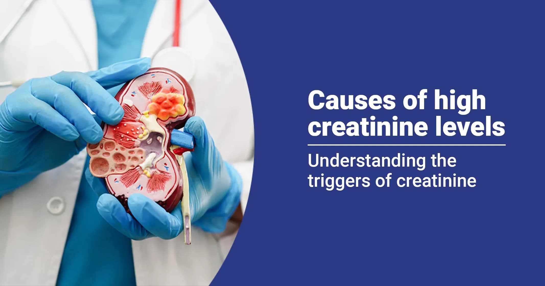 Causes, Symptoms and Treatment of High Creatinine Levels