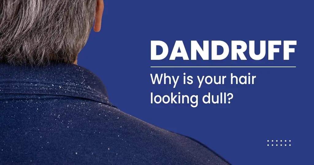 Dandruff - Causes, Symptoms and treatments 